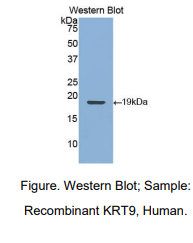 https://msimg.bioon.com/bionline/goods-no-pic.png