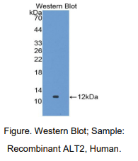 https://msimg.bioon.com/bionline/goods-no-pic.png