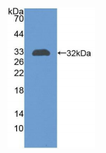 人红细胞补体受体1(CR1)多克隆抗体