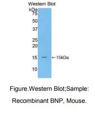 https://msimg.bioon.com/bionline/goods-no-pic.png