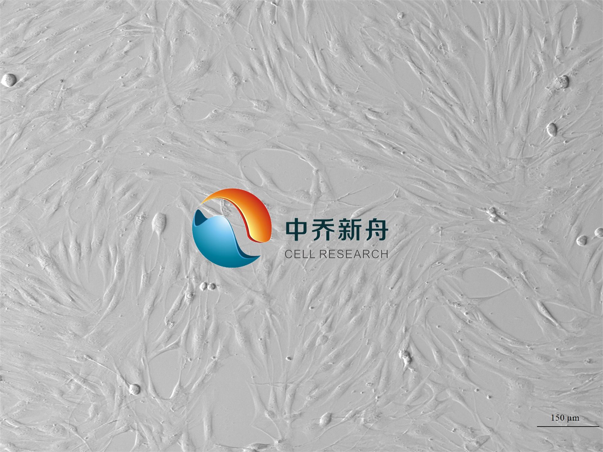 人滑膜成纤维细胞