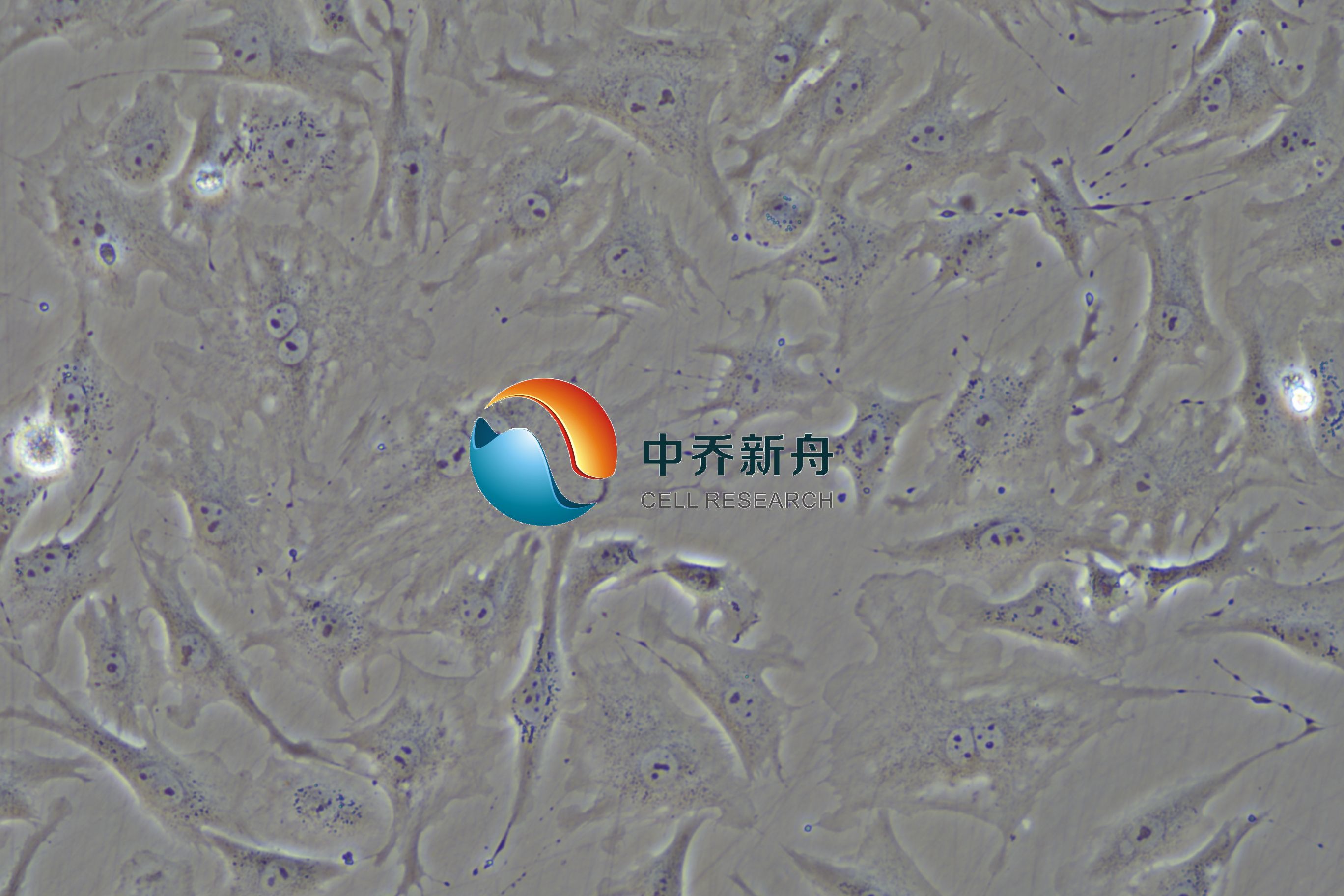 https://img.medsci.cn/8eee53bbc4cb7a98de615e72115896bc4e27fda5cbb764dbd67d9d641c2bb46a.png