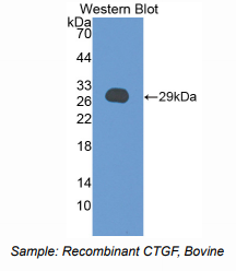牛结缔组织生长因子(CTGF)多克隆抗体