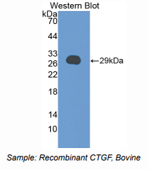 https://msimg.bioon.com/bionline/goods-no-pic.png