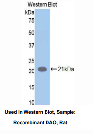 https://msimg.bioon.com/bionline/goods-no-pic.png