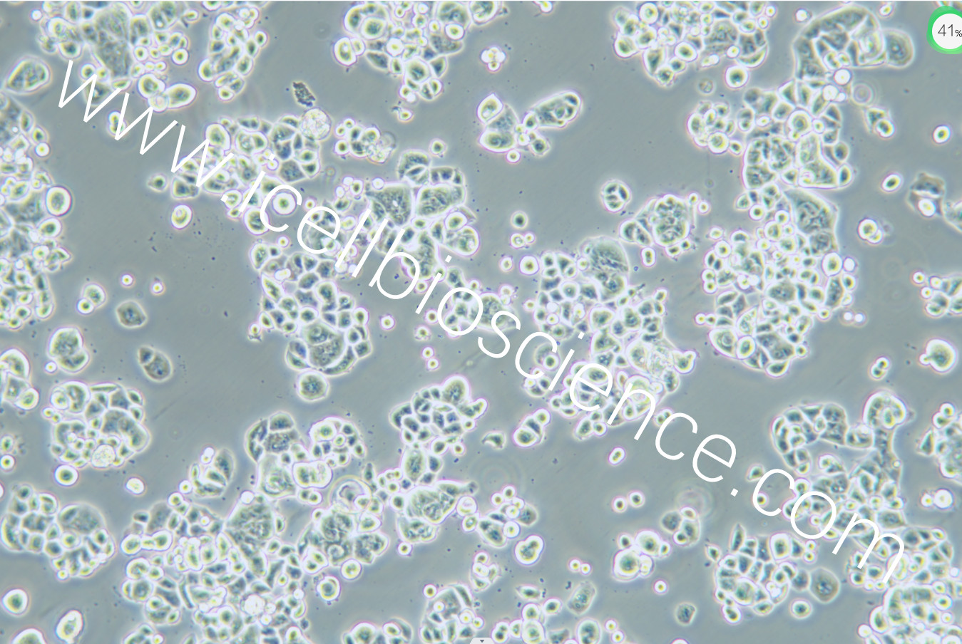 ZR-75-30细胞/ZR75-30细胞/ZR-7530细胞/ZR7530细胞/ZR75-30/ZR-7530/ZR7530/人乳腺癌细胞