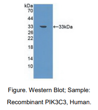 https://msimg.bioon.com/bionline/goods-no-pic.png