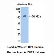 https://msimg.bioon.com/bionline/goods-no-pic.png