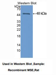 https://msimg.bioon.com/bionline/goods-no-pic.png