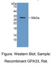 https://msimg.bioon.com/bionline/goods-no-pic.png