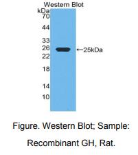 大鼠生长激素(GH)多克隆抗体