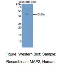 https://msimg.bioon.com/bionline/goods-no-pic.png