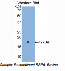 https://msimg.bioon.com/bionline/goods-no-pic.png