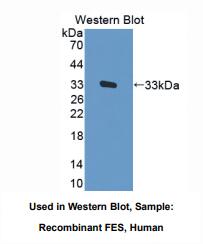 https://msimg.bioon.com/bionline/goods-no-pic.png