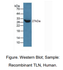 https://msimg.bioon.com/bionline/goods-no-pic.png