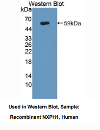 https://msimg.bioon.com/bionline/goods-no-pic.png