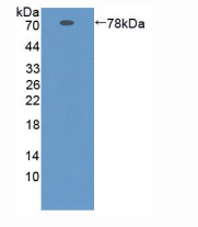 https://msimg.bioon.com/bionline/goods-no-pic.png