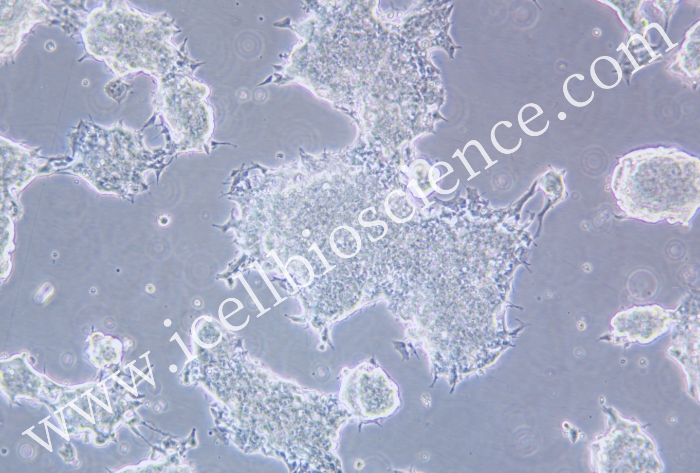 NCI-H209细胞/NCI-H209细胞/NCI-H209/NCI-H209/人小细胞肺癌细胞