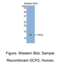 人粒细胞趋化蛋白2(GCP2)多克隆抗体