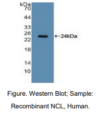 https://msimg.bioon.com/bionline/goods-no-pic.png