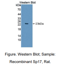 https://msimg.bioon.com/bionline/goods-no-pic.png