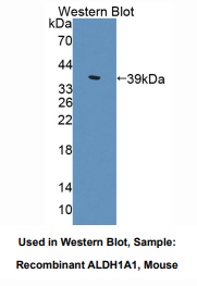 小鼠醛脱氢酶1家族成员A1(ALDH1A1)多克隆抗体