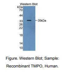 人胸腺生成素(TMPO)多克隆抗体