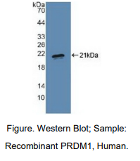 https://msimg.bioon.com/bionline/goods-no-pic.png