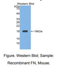 https://msimg.bioon.com/bionline/goods-no-pic.png