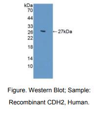 https://msimg.bioon.com/bionline/goods-no-pic.png