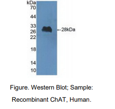 https://msimg.bioon.com/bionline/goods-no-pic.png