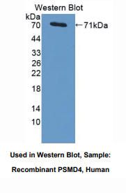 https://msimg.bioon.com/bionline/goods-no-pic.png