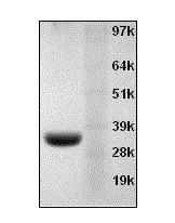 https://img.medsci.cn/e73eefcea40976357f460123cbf1e819c54e5106c9b457225be13b1cbc991aff.png