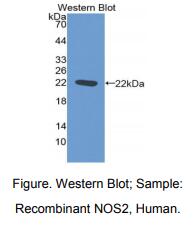 人诱导型一氧化氮合酶(NOS2)多克隆抗体