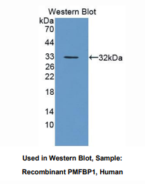 https://msimg.bioon.com/bionline/goods-no-pic.png