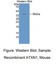 小鼠失调蛋白1(ATXN1)多克隆抗体