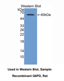 大鼠葡萄糖6磷酸脱氢酶(G6PD)多克隆抗体