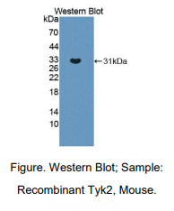 小鼠酪氨酸激酶2(Tyk2)多克隆抗体