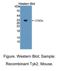 https://msimg.bioon.com/bionline/goods-no-pic.png