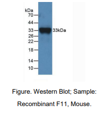 https://msimg.bioon.com/bionline/goods-no-pic.png