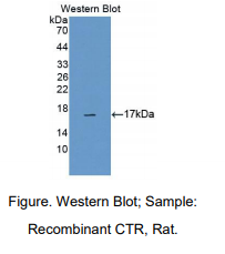 https://msimg.bioon.com/bionline/goods-no-pic.png