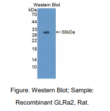 https://msimg.bioon.com/bionline/goods-no-pic.png