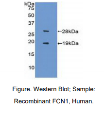 https://msimg.bioon.com/bionline/goods-no-pic.png