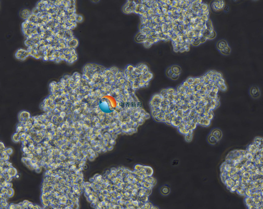 https://img.medsci.cn/8eee53bbc4cb7a98de615e72115896bc4e27fda5cbb764dbd67d9d641c2bb46a.png