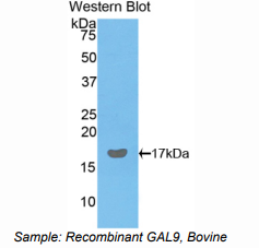 https://msimg.bioon.com/bionline/goods-no-pic.png