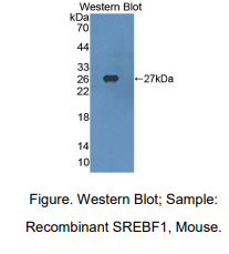 https://msimg.bioon.com/bionline/goods-no-pic.png