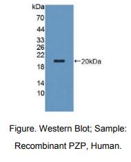 人妊娠带蛋白(PZP)多克隆抗体