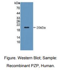 https://msimg.bioon.com/bionline/goods-no-pic.png