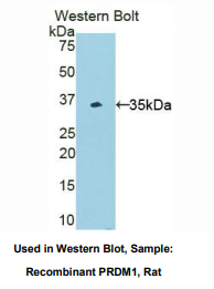 https://msimg.bioon.com/bionline/goods-no-pic.png