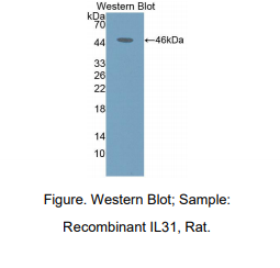 https://msimg.bioon.com/bionline/goods-no-pic.png